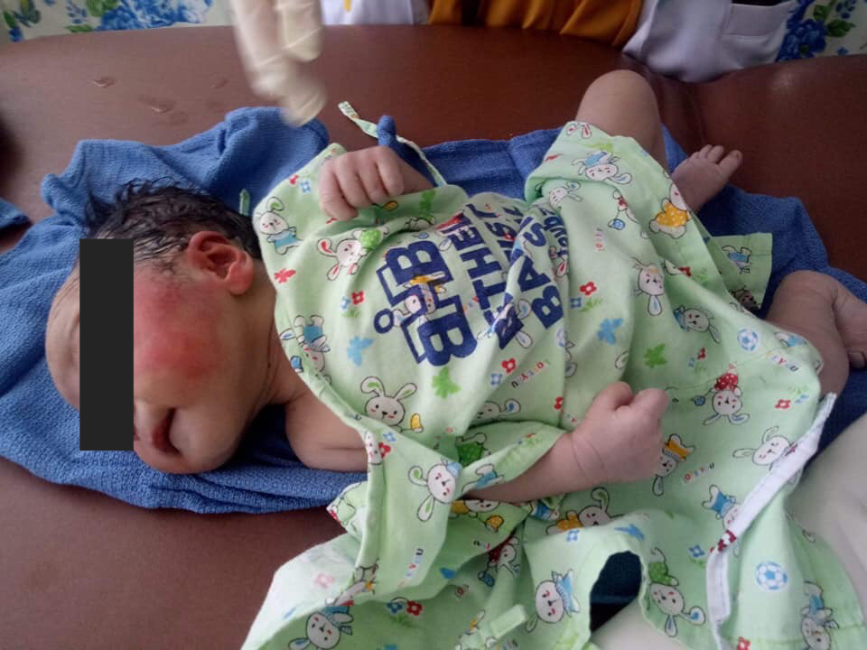 Newborn baby found abandoned at Barangay 3, Malaybalay